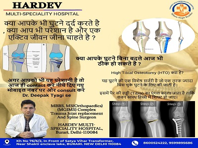 Deformity Correction