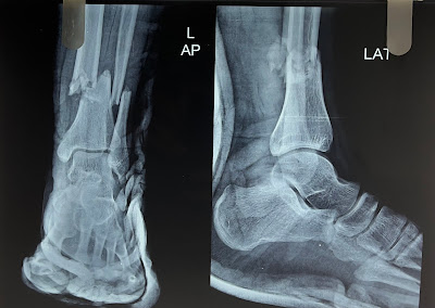 Paediatric Orthopaedics